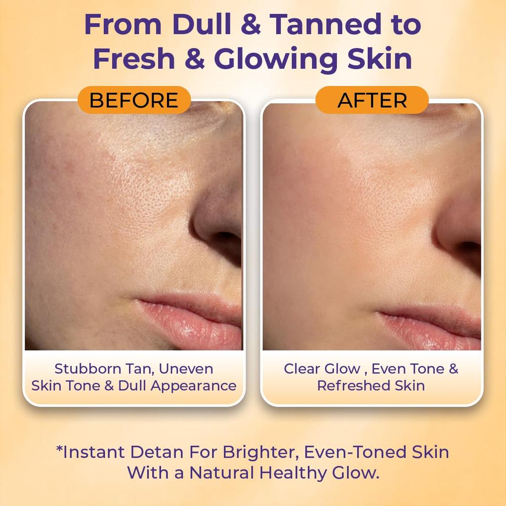 Sanfe Tan Erase Complete Body D-Tan Kit | 150gm + 50ml | 4-Step Body D-Tan Spa Ritual | Removes Stubborn Sun Tan in 20 Minutes | With Glycolic Acid