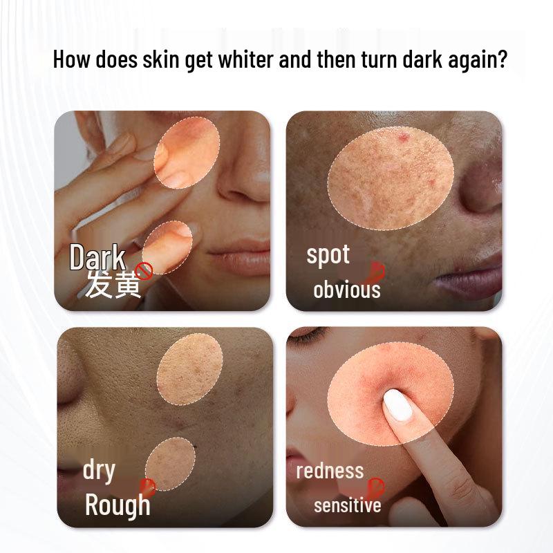 377 Spot-Fading & Brightening Essence Set: Whitening, Hydrating, Anti-Wrinkle, Firming Toner & Moisturizer for Autumn/Winter.
