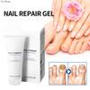 Nail Care Gel Hand Foot Onychomycosis Soft Nail Thickening Nail Luminescent Nail Repair Gel
