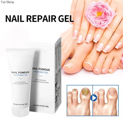 Nail Care Gel Hand Foot Onychomycosis Soft Nail Thickening Nail Luminescent Nail Repair Gel