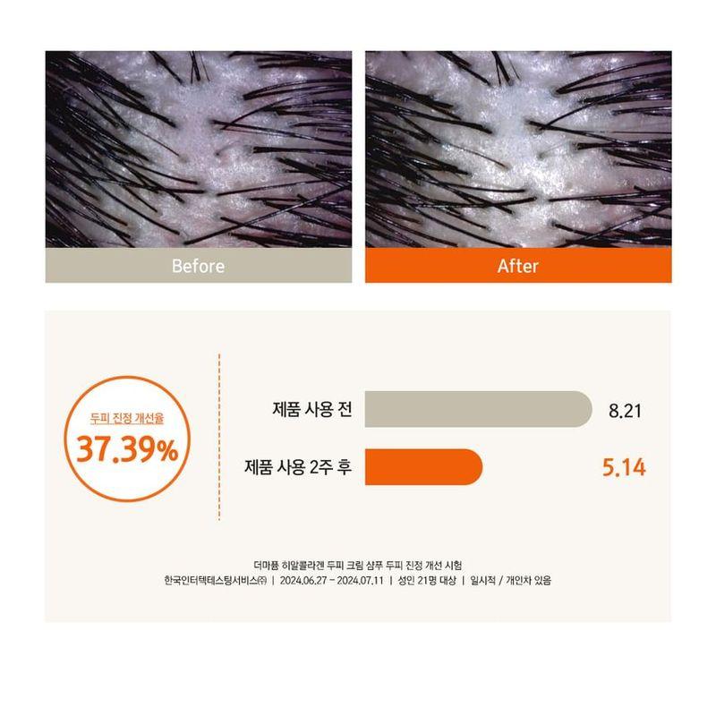 Dr. Bio - Dermafume Hyalcollagen Scalp Cream Shampoo