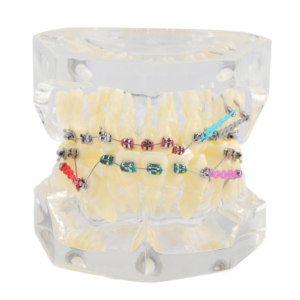 Dental Orthodontic Treatment Malocclusion Study Teeth Model With Wire Chain