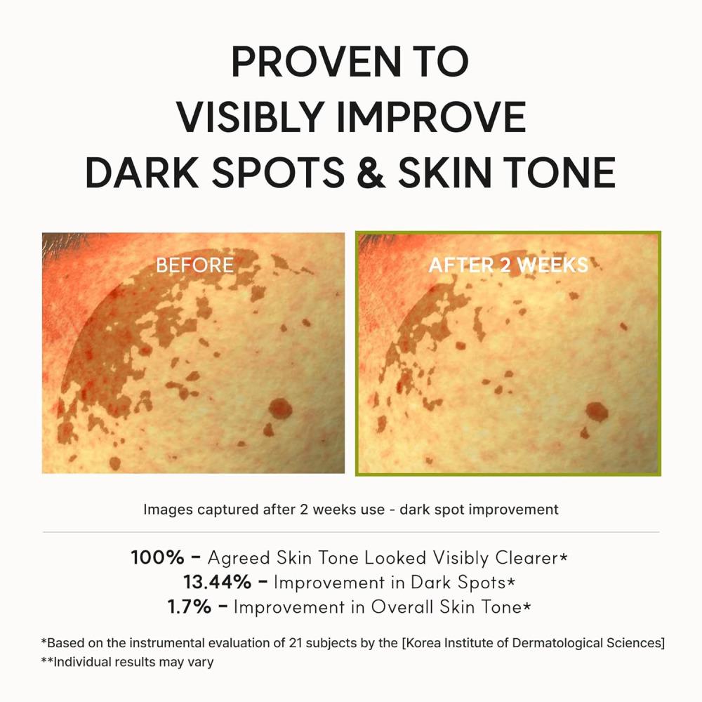 arencia Dose de Reforço de Vitamina C 30ml