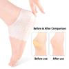 2pcs/4pcs New Silicone Heel Protectors Plantar Fasciitis Heel Socks Reducing Pressure on Soles Pain Relief Foot Care Products