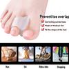1-10pair Silicone Bone Thumb Orthotics Corrector Hallux Valgus Toe Separator Feet Care Thumb Orthotics Foot Care Products