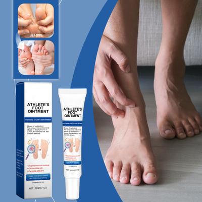 Wolfsbane Athlete's Foot Ointment And Refreshing Foot Athlete's Foot Ointment Anti-itching And Peeling Wolfsbane To Remove Foot Odor, Sweat And Athl
