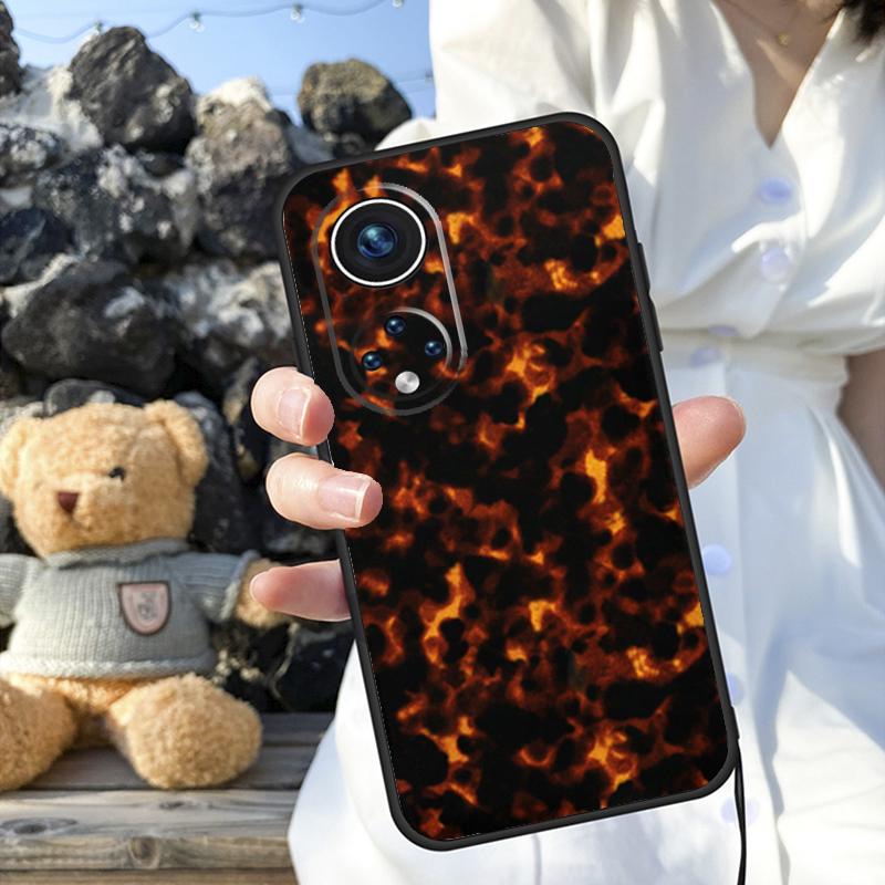 Tortoise Pattern Tortoiseshell Case For Honor Magic 6 Pro 90 70 50 Magic 5 Lite X6 X7 X8 X9 X6a X7a X8a X9a X8b X9b Cover