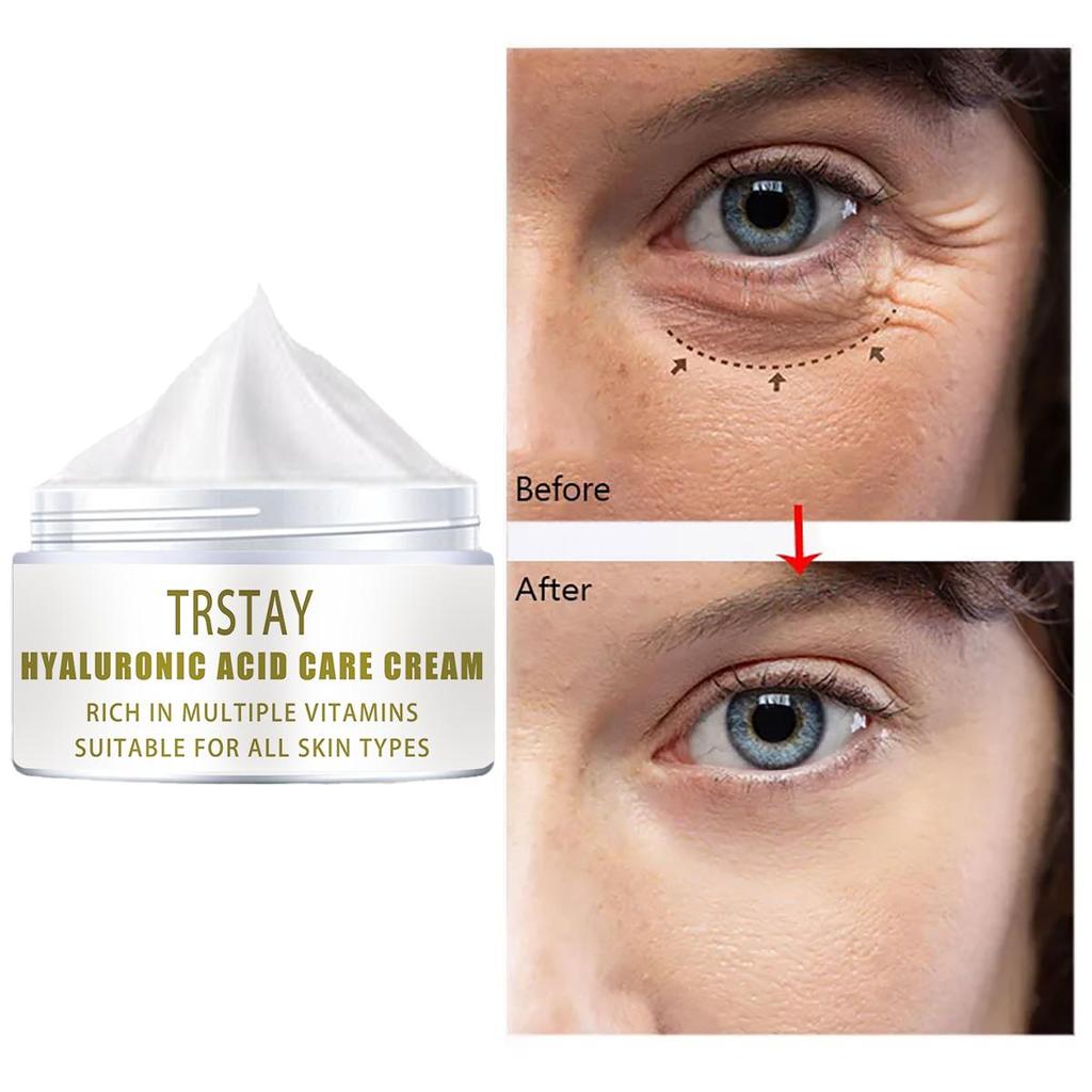 The Wrinkle-smoothing Cream Is Gentle and Non-irritating, Smoothing Wrinkles, Lightening Fine Lines and Leaving Skin Soft and Refined