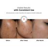 Ellitee ClearGel Anti Acne Face Wash for Oily & Acne-Prone Skin - 2% Salicylic Acid & 0.5% Glycolic Acid Gel Cleanser - Oil Control Pimple Treatme