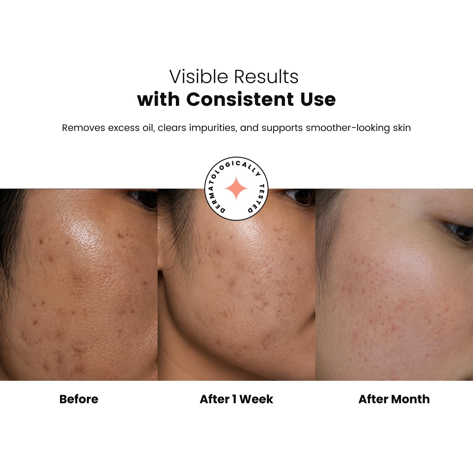 Ellitee ClearGel Anti Acne Face Wash