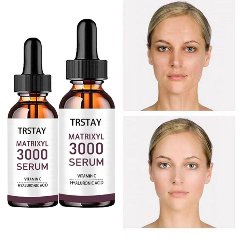 5ML/15ML/30ML/50ML/TRSTAY Ultimate Wrinkle-Reducing Face Serum for Radiant Skin