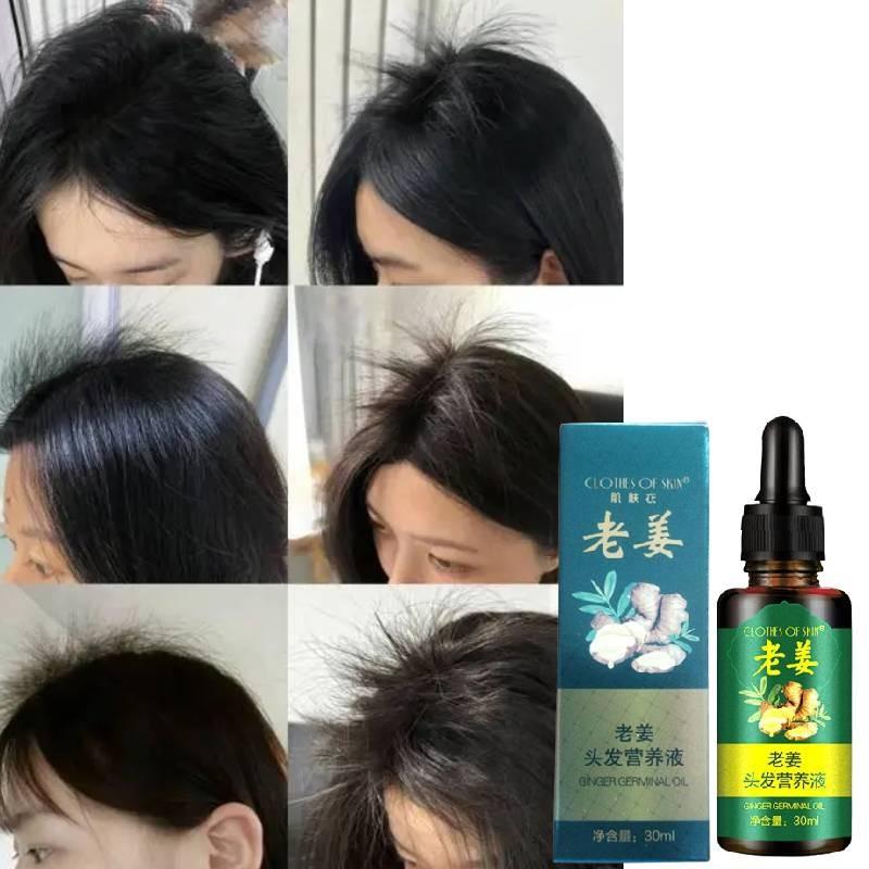 Nourishing Ginger Hair Essence For Healthy And Shiny Locks With Oil Control Benefits