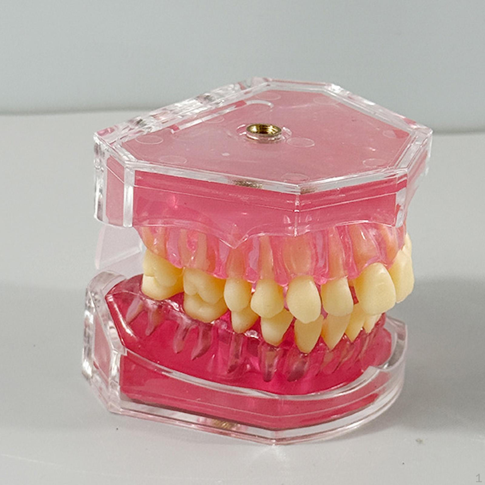 

Модель для удаления зубов Домашние учебные пособия Демонстрационный дисплей