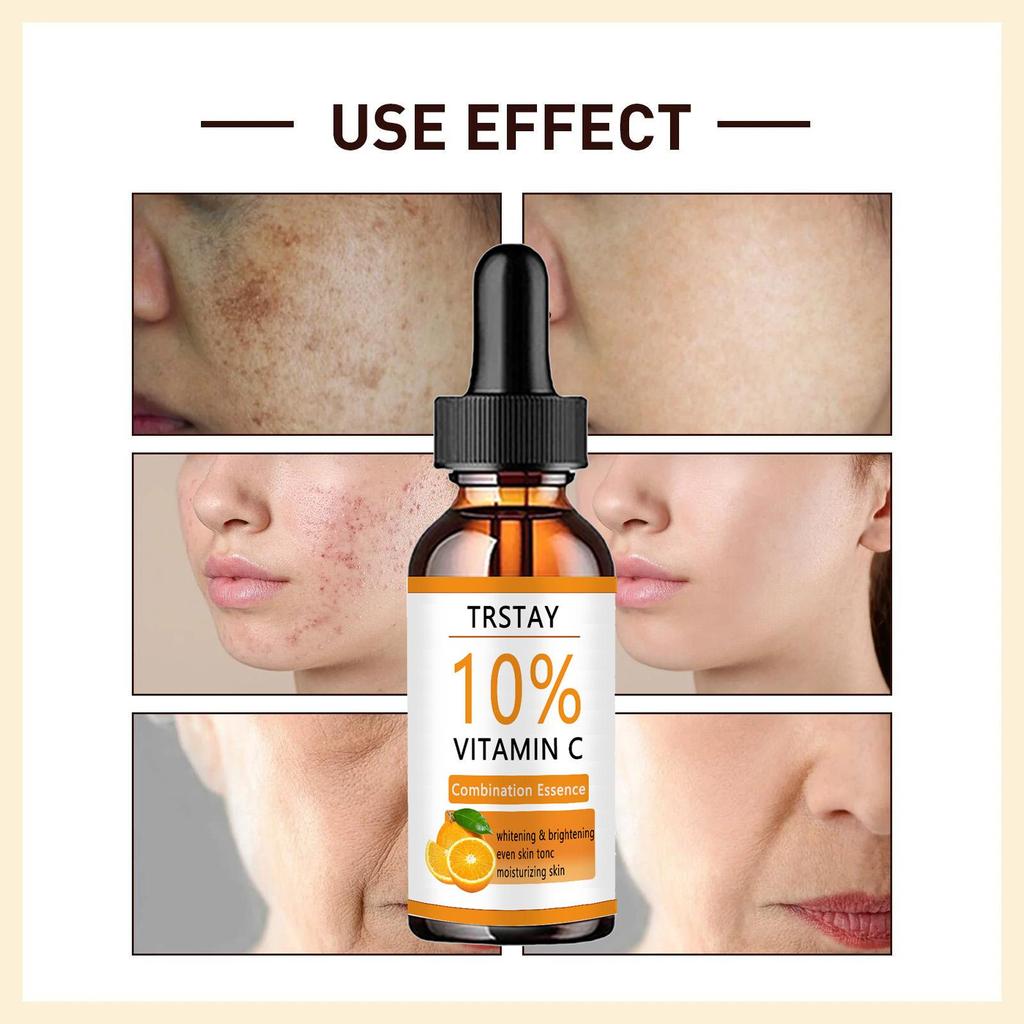 Moisturizer for neck and décolleté, double chin reducer, skin tightening cream  skin whitening cream