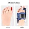 Bunion Relief Toe Separator: Night-use Corrector Strap for Big Toe Alignment