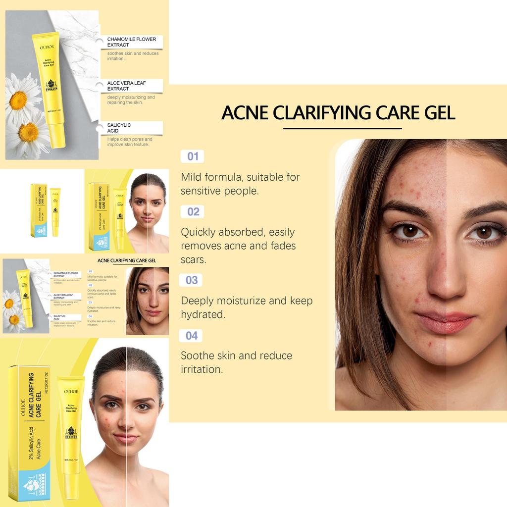 Ouhoe Acne Gel For Deep Cleansing And Brightening Skin With Pore Minimizing Formula 20g