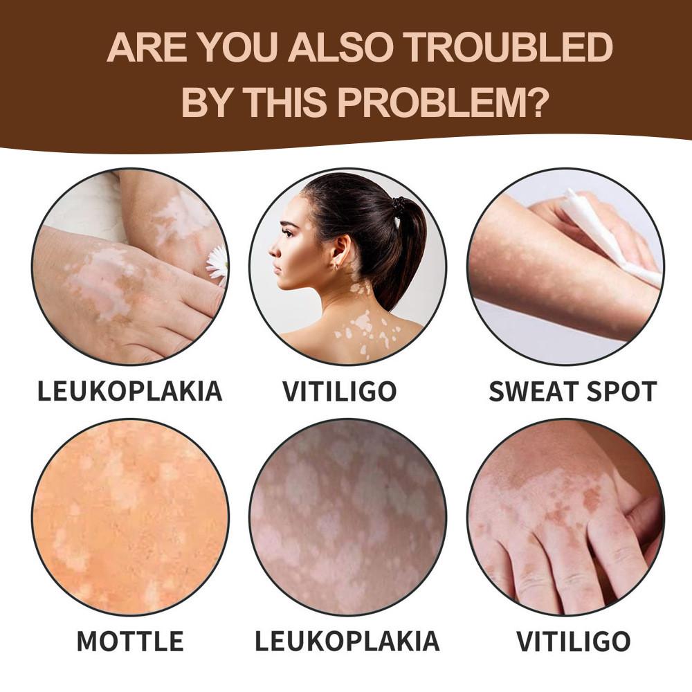 Body Gentle Whitening Cream For Skin Spot Care Formulated For All Skin Types