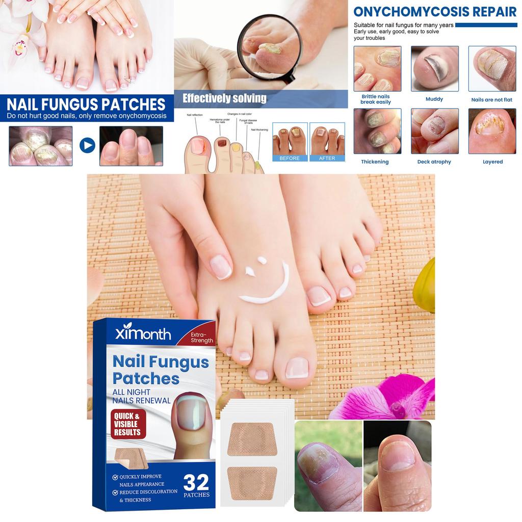 Ximonth Nail Care Patches Repairing Thickening Strengthening For Damaged Nails