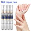 Nail Fungal Liquid Fast Onychomycosis Fungus Nails Demethylation Essential Oil Natural Plant Extracts Nail Shine Nail Care