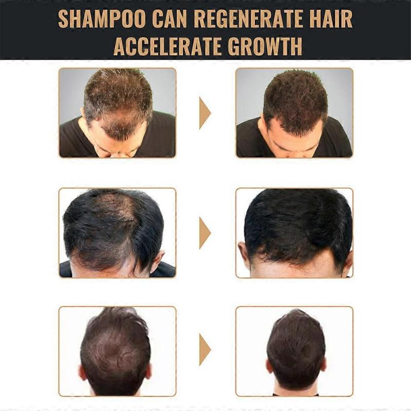 Spartan Shampoo Spartan Root Activator Shampoo Natürliche Haarwuchs Shampoos