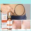 Eelhoe Skin Repair Oil For Pregnant Women Luxurious Tightening And Smoothing Serum For Daily Care