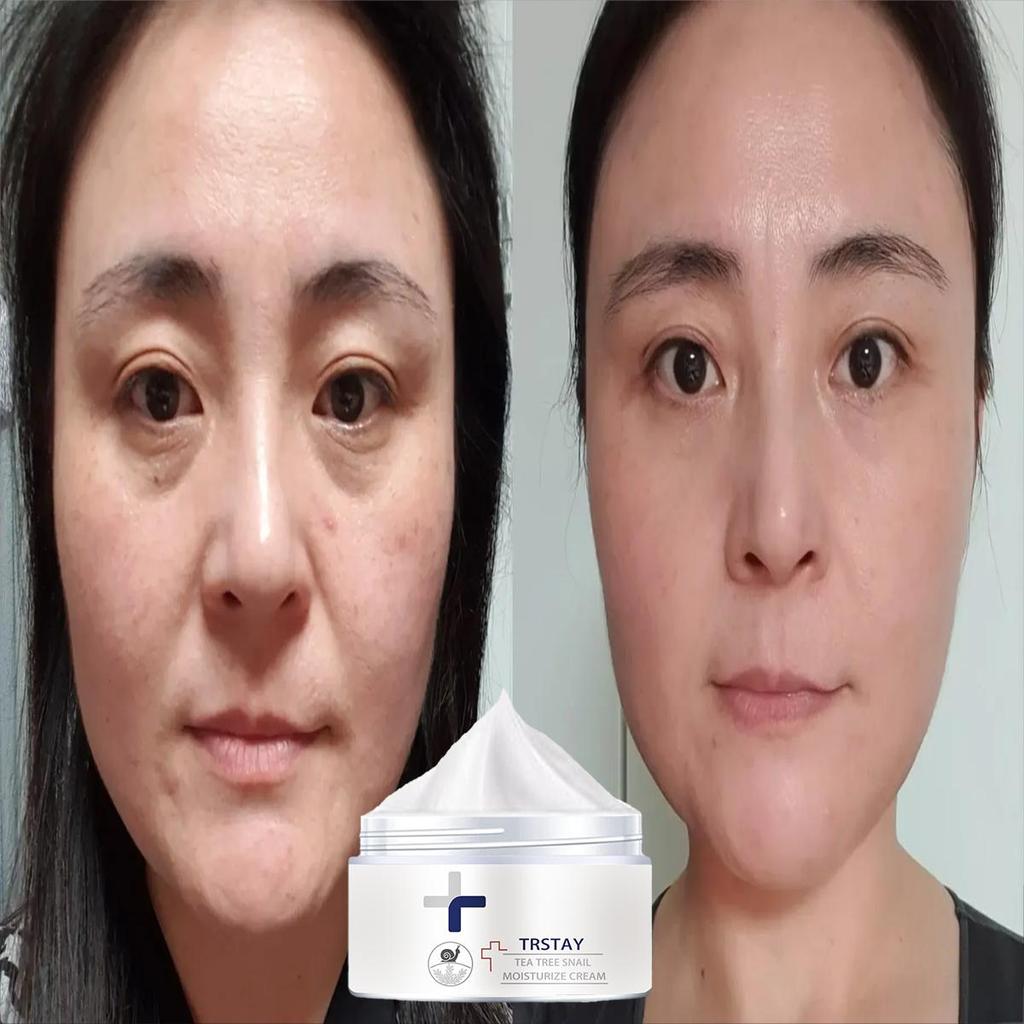 Moisturizing Cream Is Gentle and Non-irritating, Firms the Skin, Brightens the Complexion, Reduces Blemishes, Hydrates and Nourishes the Skin