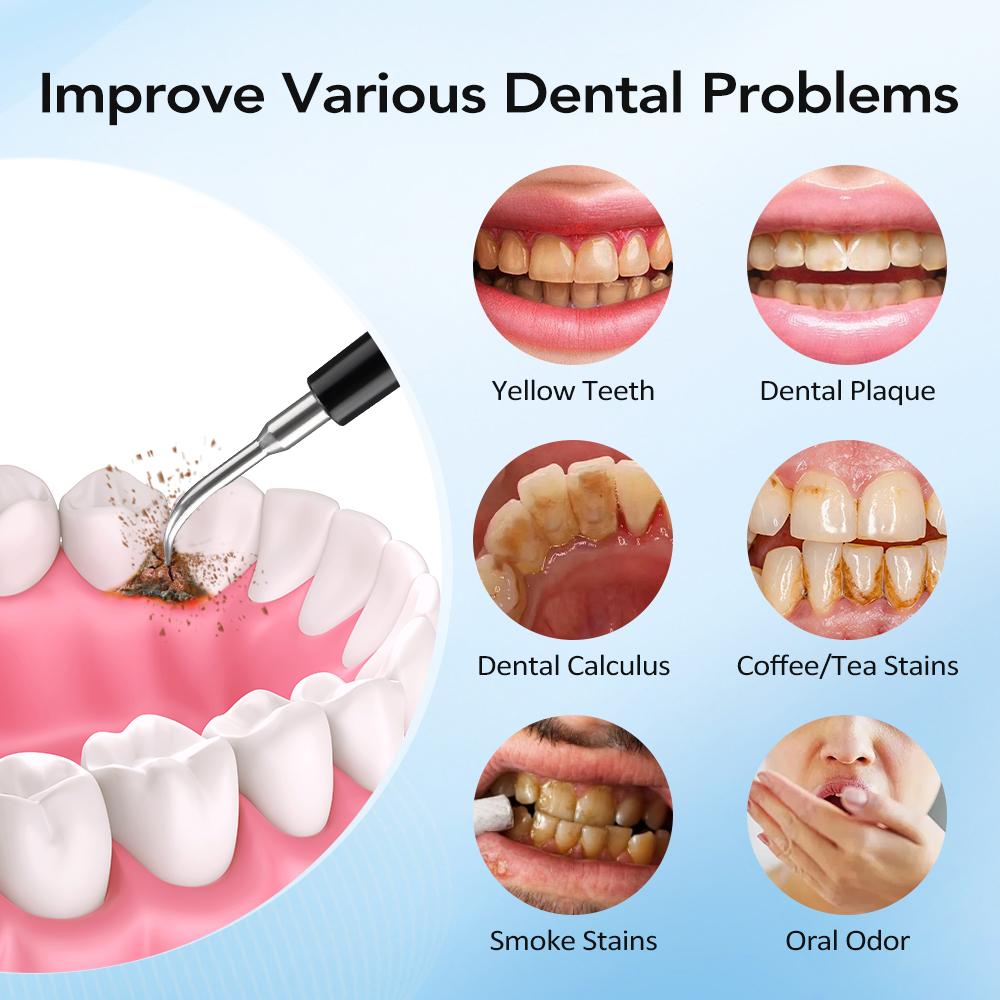 Electric Dental Scaler Tartar Calculus Remover 5 Mode Portable Toothbrush Vibration Sonic Tooth Cleaner Teeth Whitening Cleaning
