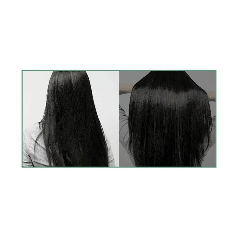 Dr.FORHAIR - Phyto Therapy Treatment Jumbo