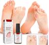 MAMMA VITA Foot Corn Removal Gel – Fast-Acting Corn & Callus Remover with Gentle Exfoliating Formula | Softens Hard Skin, Removes Dead Cells & Res