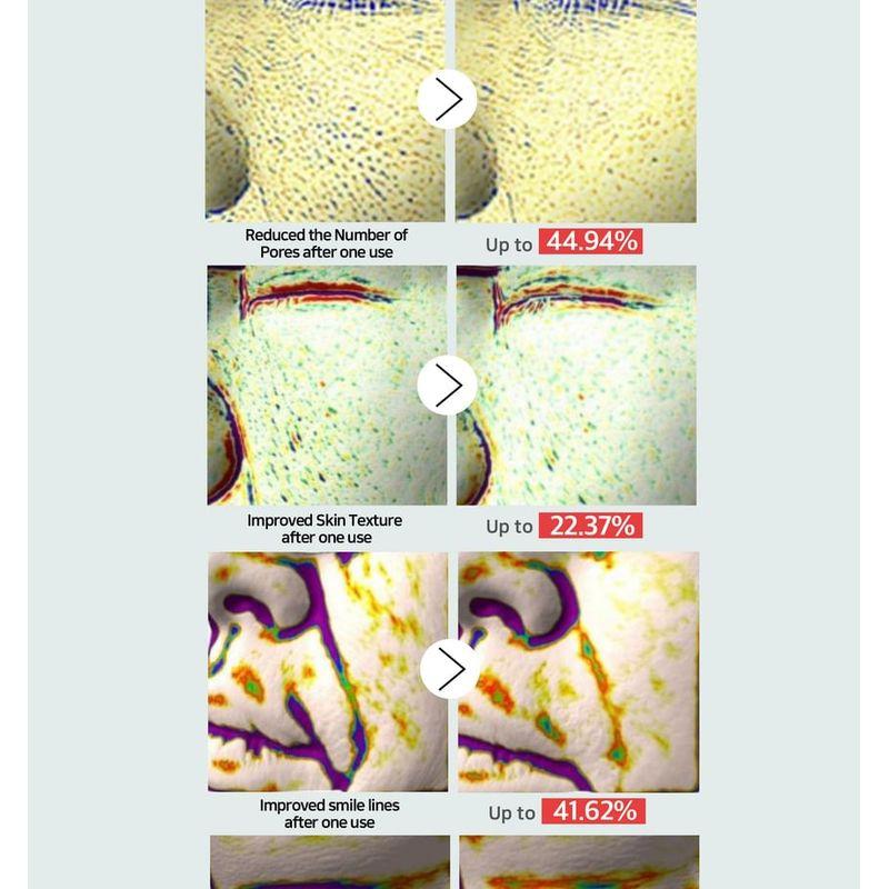 PESTLO - Rejurecipe MTS Roller Serum