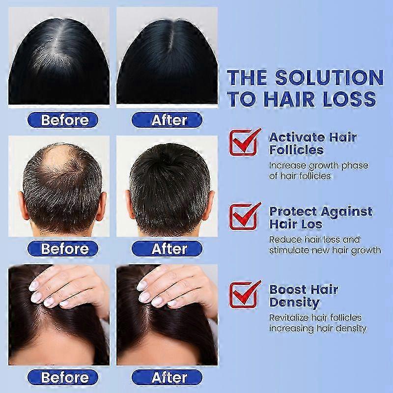 GHK-Cu Copper Peptide Hair & Scalp Serum Spray  Fast-Absorbing, Water-Based Formula for Hair Softness & Shine - Dry Scalp Moisturizer Spray