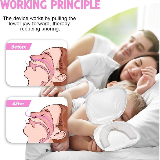 Anti-Snore Mouthguard - Anti-Snoring Device, Anti-Snoring Mouthpiece Reduce Snoring, Do Not Disturb Others to Rest and Rest Easily and Quietly All