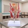 Anorectal Model with Base Hemorrhoid Enlarged for Doctors, Teachers, Training Display,