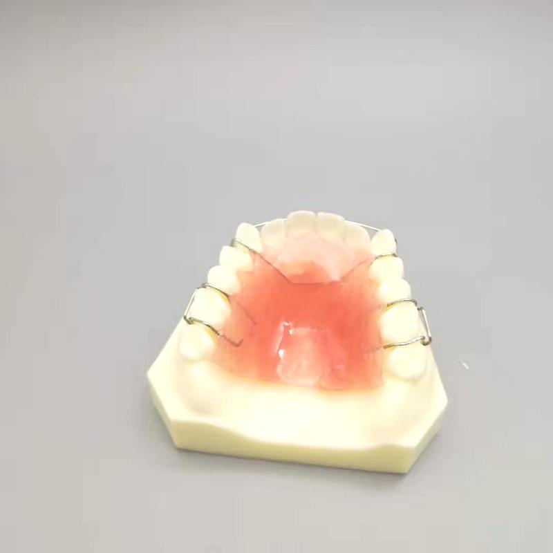 Maxillary Partial Denture Demonstration Model - White Tooth for Doctor-Patient Communication (Free Shipping)