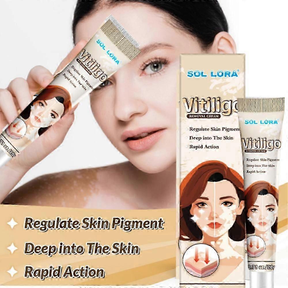 Vitiligo Cream, Anti-Vitiligo Cream, Reduce White Spots and Improve Skin Pigmentation, 20g