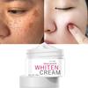 Skin Whitening Whitening Cream Spotted Freckle Fade Cream