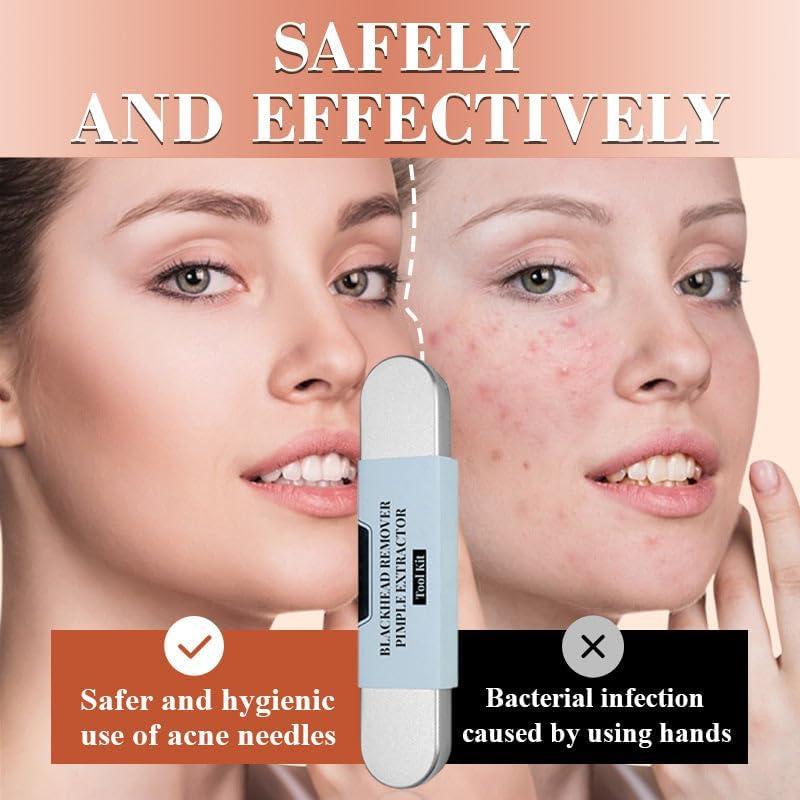 7Pcs Blackhead Remover Tool Kit Stainless Steel Comedones Extractor Pimple Acne Clip Removal Kit Nose Face Tweezer Tools