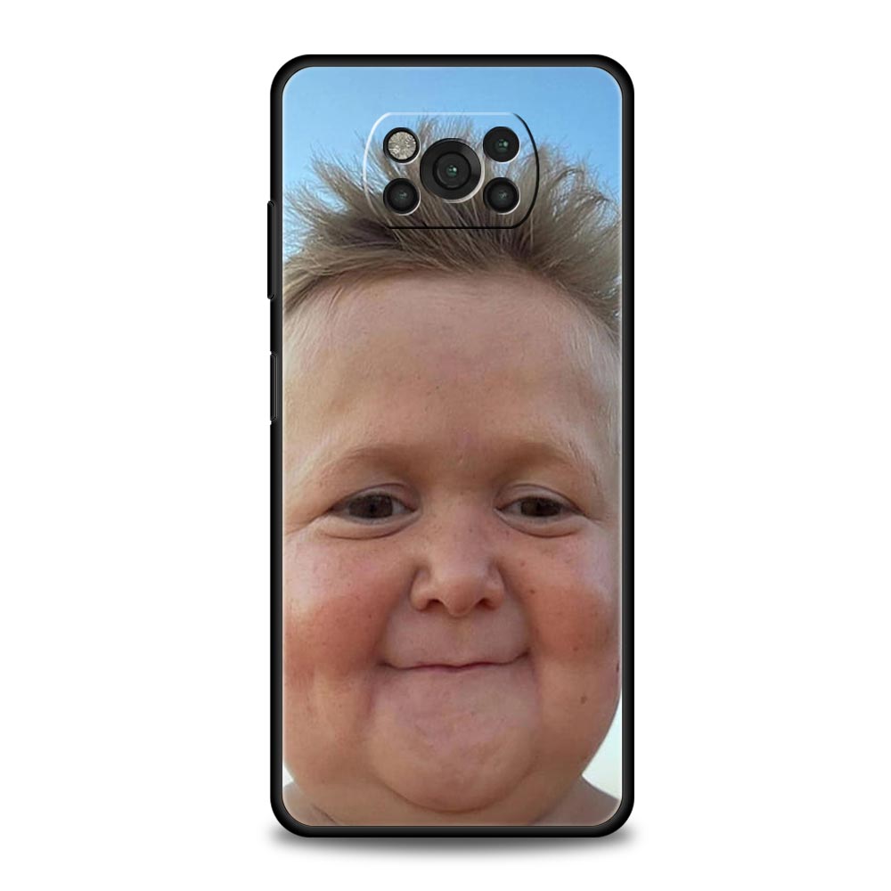Funny Hasbulla Phone Case For Xiaomi Mi Poco X3 NFC M3 F4 F3 M4 X4 Pro 5G Note 10 12 Lite 11 11T 10T 11X 13 12T Pro 9T Cover