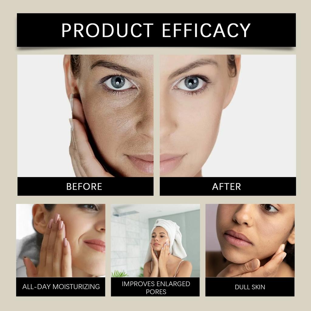 Brightening And Moisturizing Serum, Even Out Skin Tone, Improve Skin Texture, And Soothe Dry Facial Serum,30ml