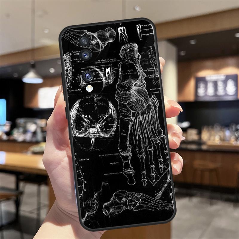 

Medical Skeleton Anatomy Case For Honor Magic 7 5 6 Lite Honor 200 Pro 50 70 90 Lite X9b X9a X8b X8a X8 X9 X9c Funda Honor 50