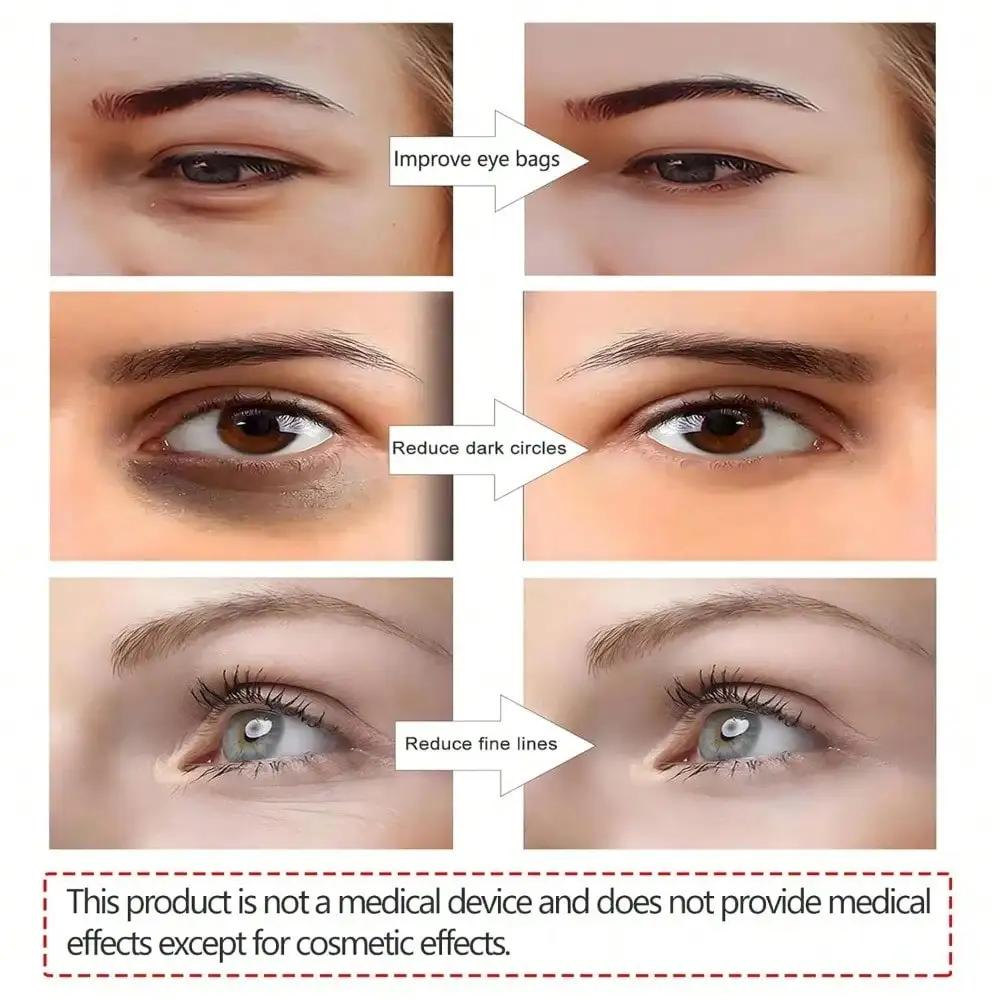 3D EMS Eye Beauty Instrument Micro-Current Pulse Eye Relax Reduce Wrinkles And Dark Circle Remove Eye Bags Massager Beauty Tool