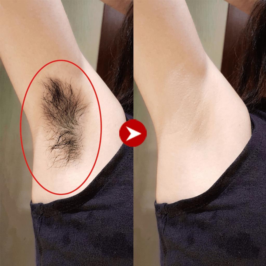 Cherry Blossom Hair Removal Cream, Fast & No Darkening, Reduces Hair Regrowth, Gentle, Painless And