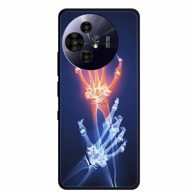 Pro pouzdro na telefon TCL 50 Pro NxtPaper Černé silikonové měkké TPU pouzdro Pro TCL 50 Pro NxtPaper 5G Zadní kryt Pouzdro 6.8" Coque Odolné proti nárazům