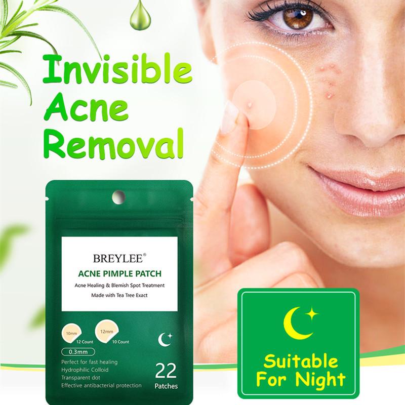 pimple care treatment