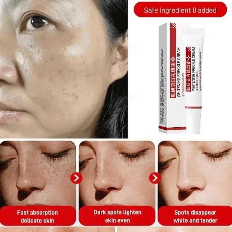 Whiten Cream Brighten Face Effective Remove Melasma Dark Spot Improve Dullness Skin Anti-pigmentation Care Cream Care Products