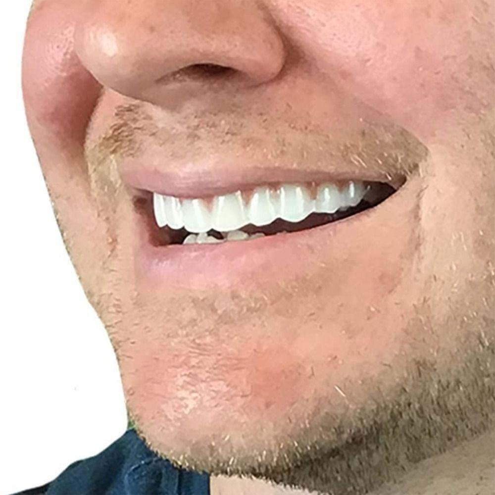 Confident Smile Silicone False Teeth Whitening Cosmetic Dental Veneer  Dental Teaching