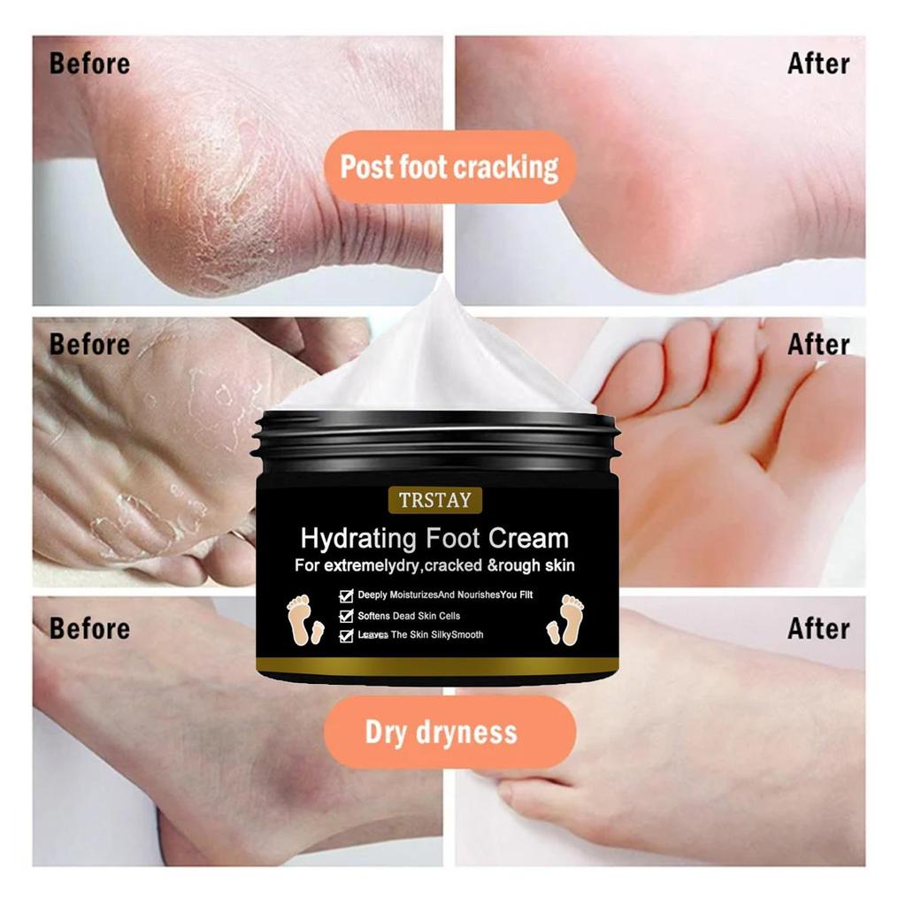 Moisturizing Foot Cream, Suitable for Extremely Dry, Cracked, and Rough Skin, Deep Moisturizing and Nourishing Skin Moisturizer