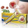 Bruising Removal Cream Joint Muscle Injury Swelling Pain Relief Ointment 30G