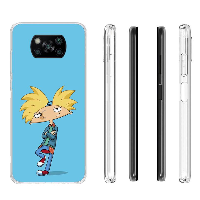 Cartoon Hey Arnold Fondos Cover Phone Case For Xiaomi Poco F7 Ultra X7 X6 X5 Pro M7 Redmi 15C 15 13C 13 12C 12 10C 10 9A 9C 9T 9