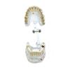 Dental Educational Model, Zamo®, Used To Exemplify Dental Pathologies, 31 Teeth, Transparent